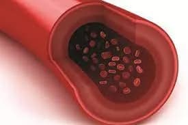 Cách nào bảo vệ thành mạch máu?