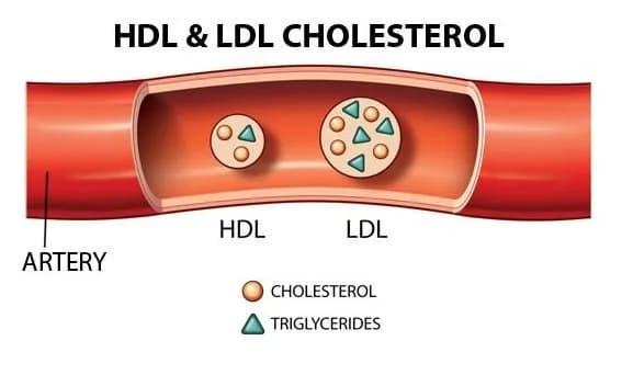 Hướng dẫn cách xem kết quả Cholesterol của bạn