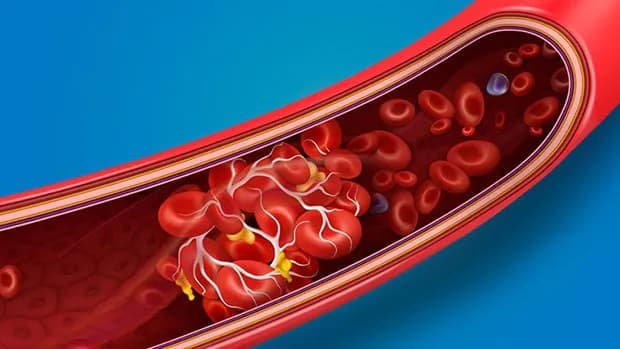 NHỮNG DẤU HIỆU NGHẼN MẠCH CẦN BIẾT