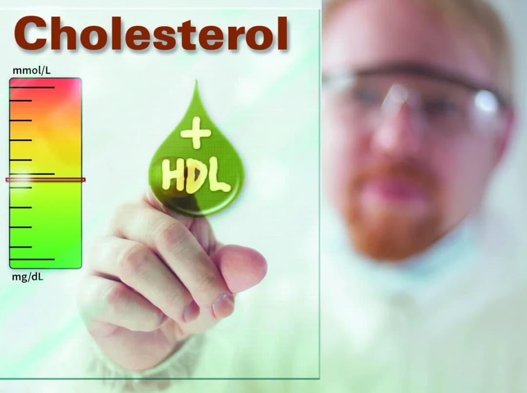 Mối quan hệ giữa tăng cholesterol và xơ vữa động mạch