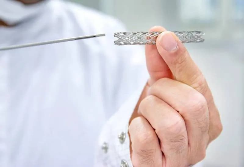 Nguy cơ và lợi ích khi đặt stent động mạch vành