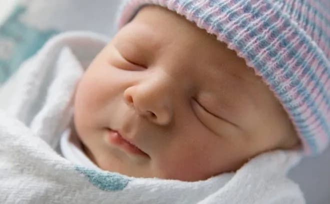 Banding động mạch phổi