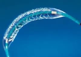Các loại stent động mạch vành phổ biến được dùng tại Việt Nam