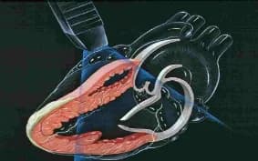 Vì sao phân suất tống máu là chỉ số quan trọng trong siêu âm tim