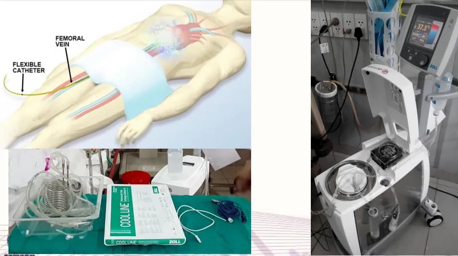 Hạ thân nhiệt trong cấp cứu và hồi sức tim mạch