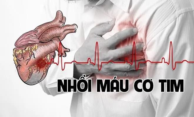 Các nguyên nhân gây đau ngực và các xét nghiệm có thể làm