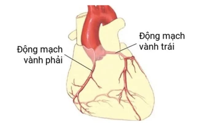 Bị hẹp, tắc động mạch vành: Ai nên đặt stent? Ai nên phẫu thuật?