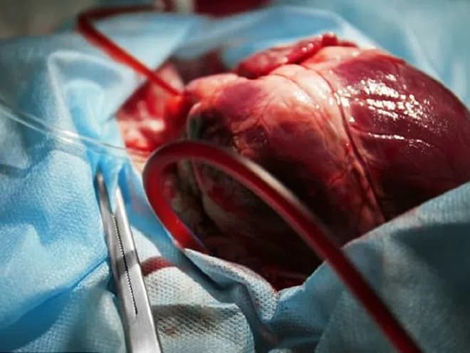 Nhịp tim đập nhanh thất thường có thể là tín hiệu cảnh báo có vấn đề từ cơ quan khác /// Shutterstock