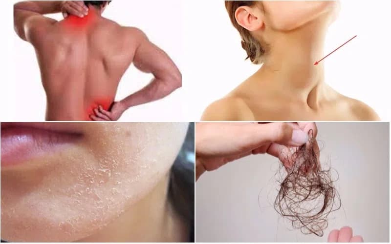 Các triệu chứng của bệnh cường giáp