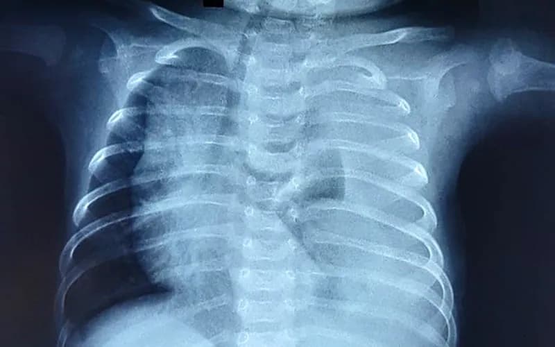 Đánh giá và xử trí ban đầu trẻ sơ sinh có tím (Phần 1)