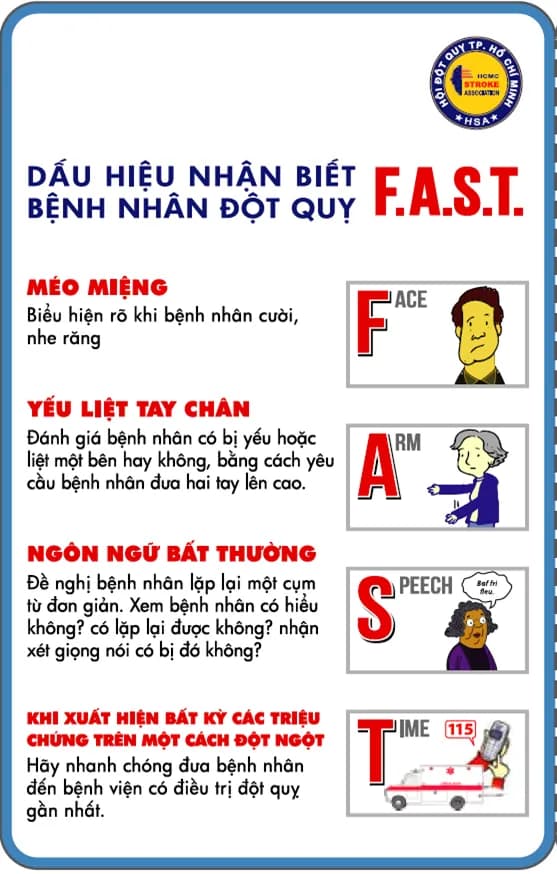 Phân loại và nhận diện triệu chứng đột quỵ