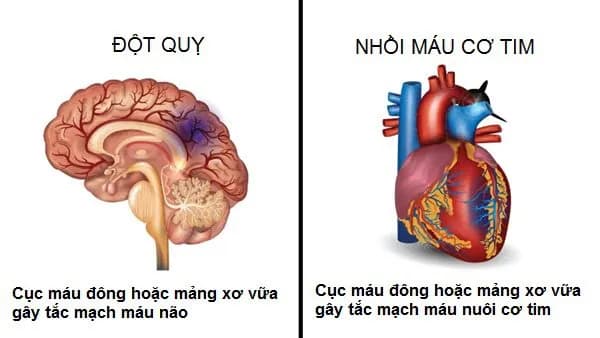 Cuồng nhĩ là gì? Những yếu tố làm tăng nguy cơ cuồng nhĩ