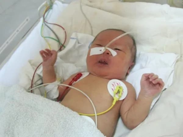 Vì sao gọi là cuồng nhĩ? Phân loại cuồng nhĩ