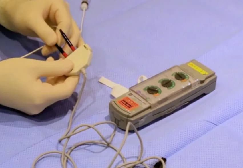 Đặt máy tạo nhịp tạm thời cấp cứu bệnh nhân tim mạch