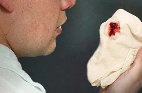 Tăng áp động mạch phổi nguy hiểm thế nào?