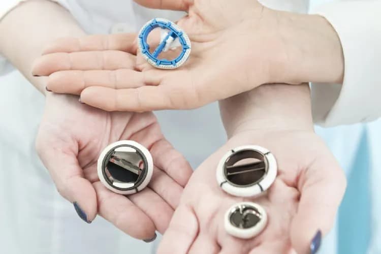 Lợi ích và nguy cơ của phẫu thuật thay van tim