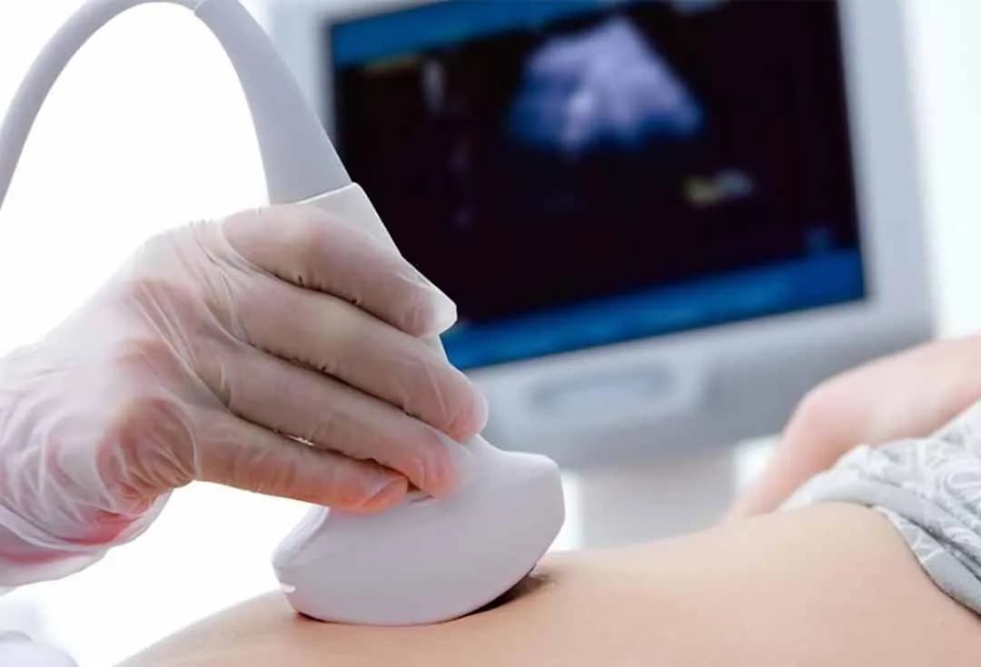 Ảnh hưởng của giãn tĩnh mạch vùng chậu