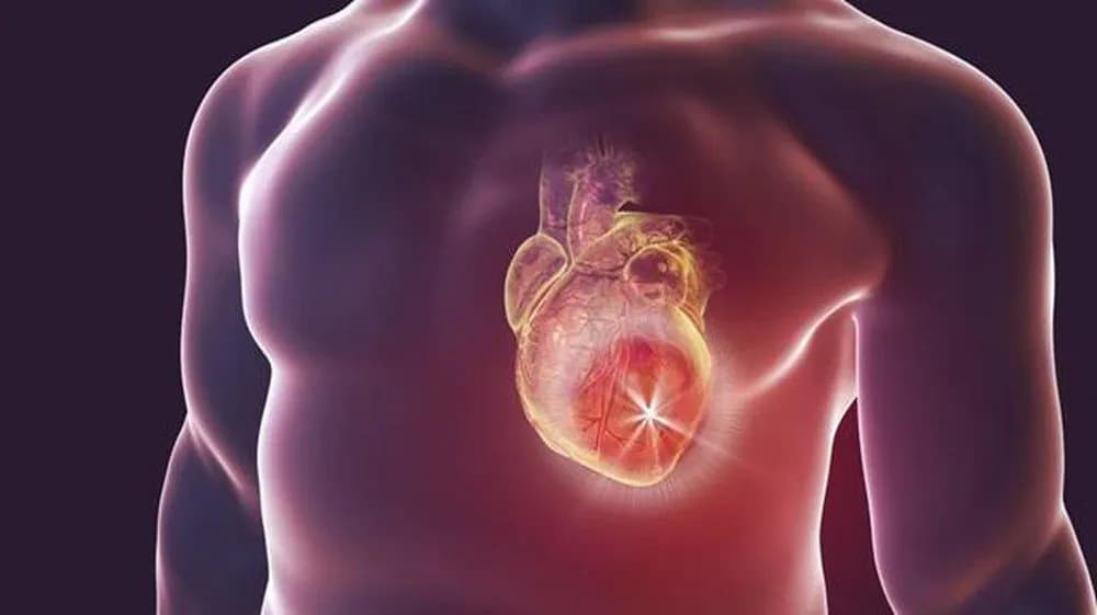 Phẫu thuật điều trị hẹp eo động mạch chủ