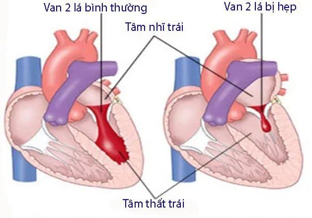 Vấn đề tim mạch và thai kỳ