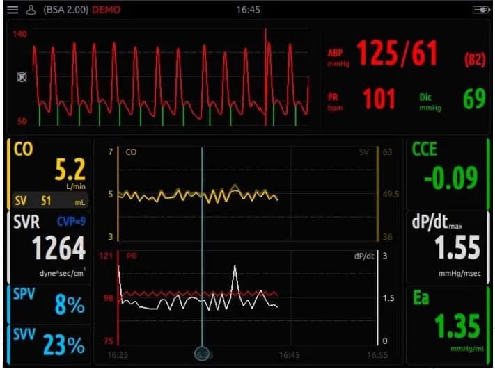 Tìm hiểu các chỉ số huyết động quan trọng