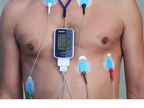 Đo điện tim holter 24h giúp chẩn đoán bệnh mạch vành