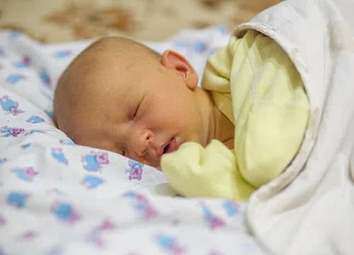 Bệnh teo đường mật bẩm sinh