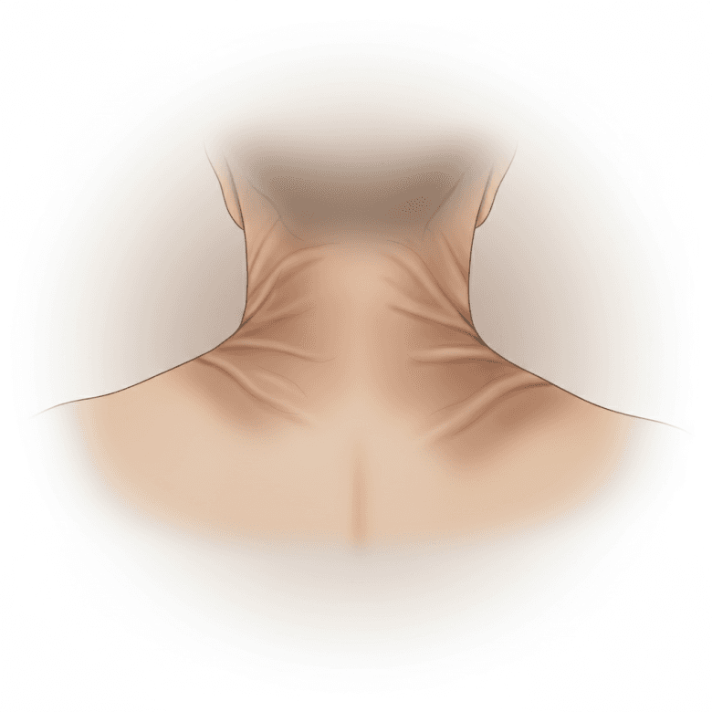 5 dấu hiệu kháng insulin dễ bị bỏ qua ở người trẻ